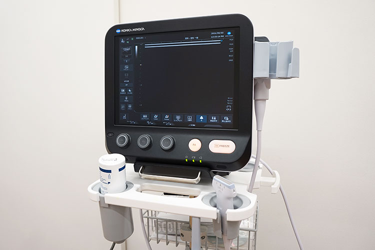 超音波診断装置